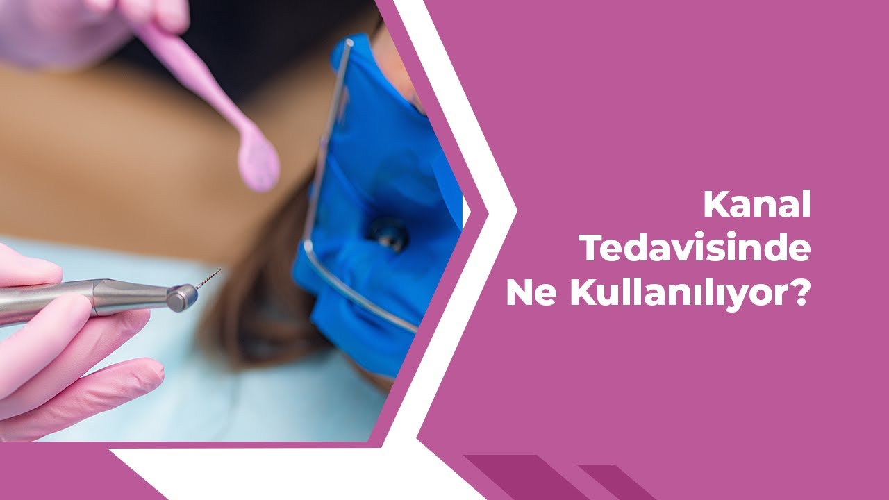 Kanal Tedavisinde Ne Kullanılıyor?