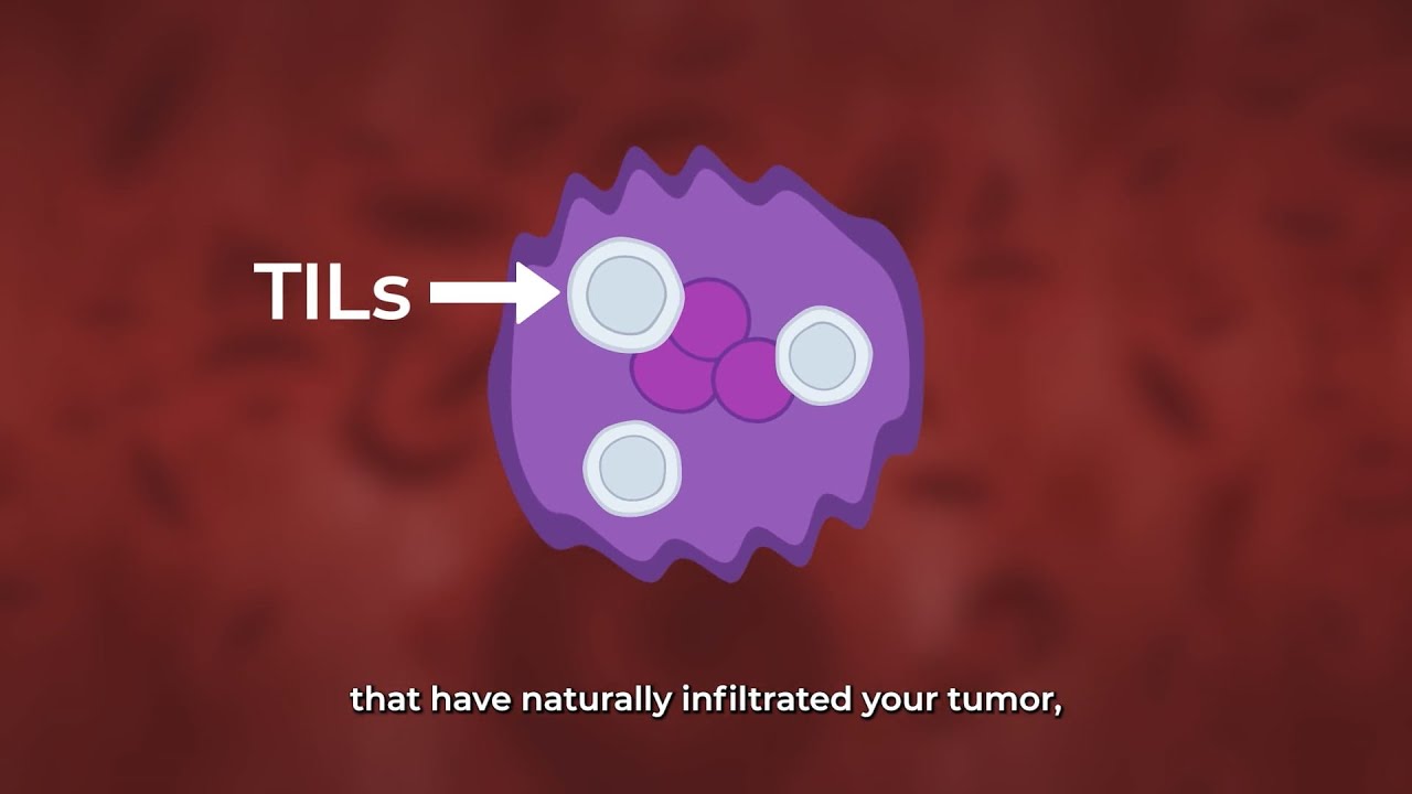 Tumor-Infiltrating Lymphocytes (TIL) Immunotherapy - ImPACT Program: