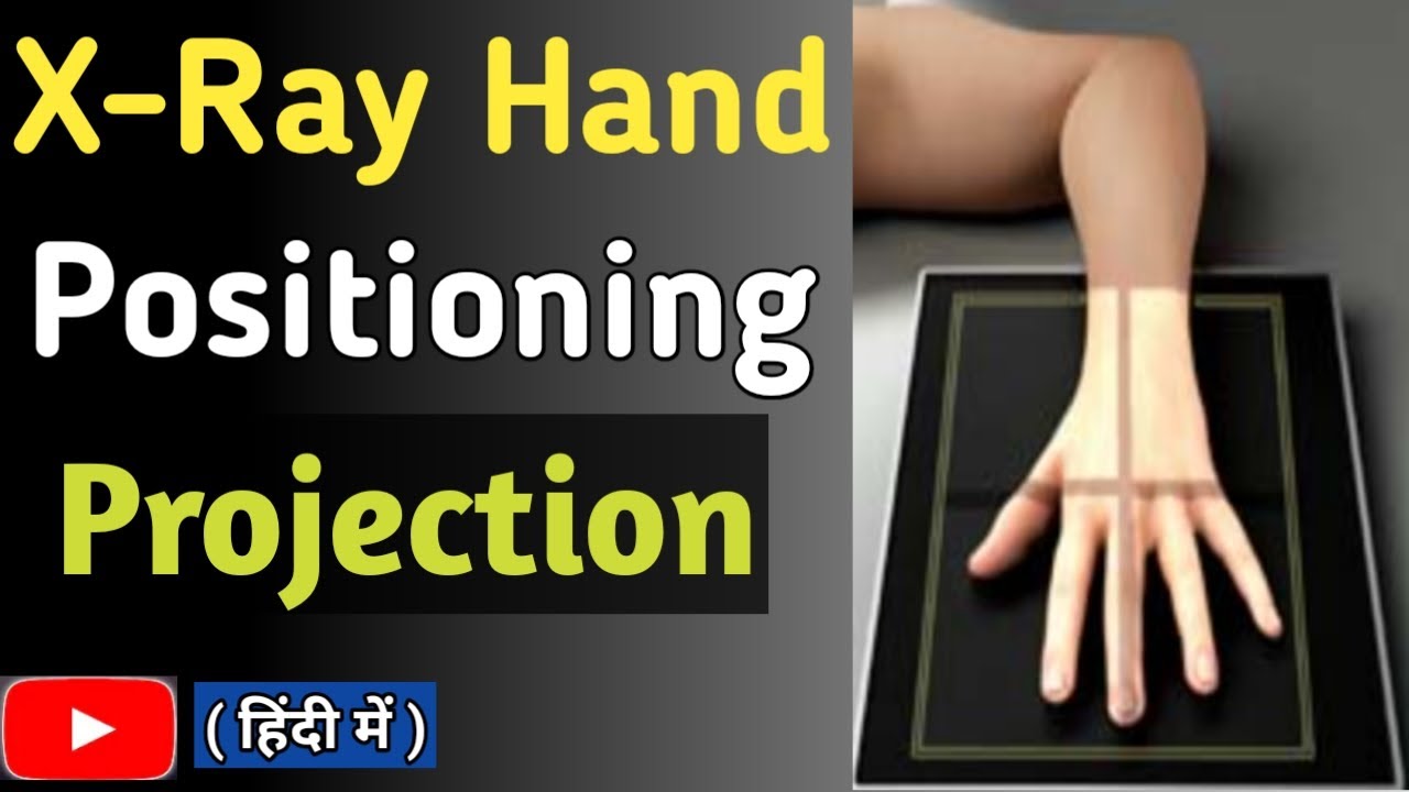 Hand X-Ray Positioning | Hand PA/Oblique/Lateral View | Hand Fan Lateral View | UdayXray