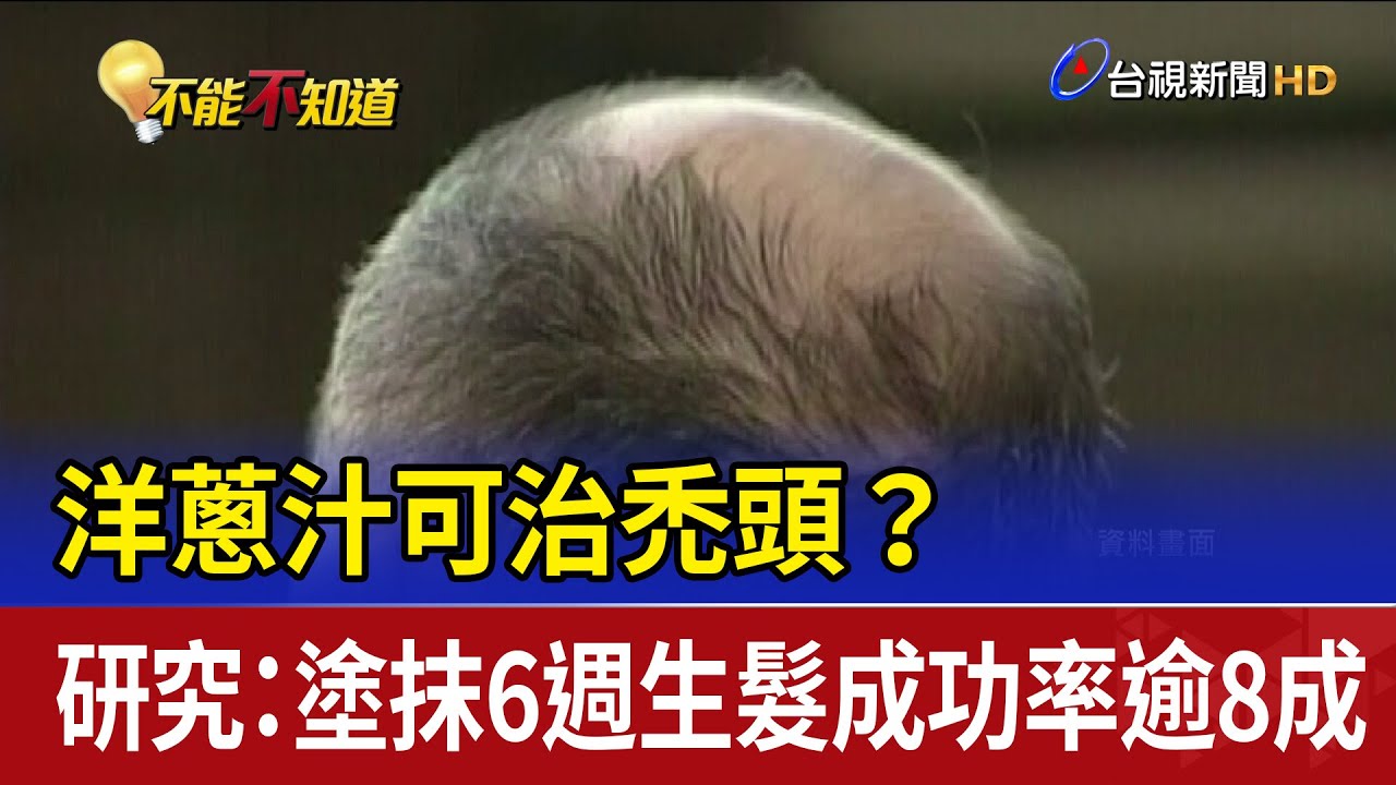 洋蔥汁可治禿頭？ 研究：塗抹6週生髮成功率逾8成