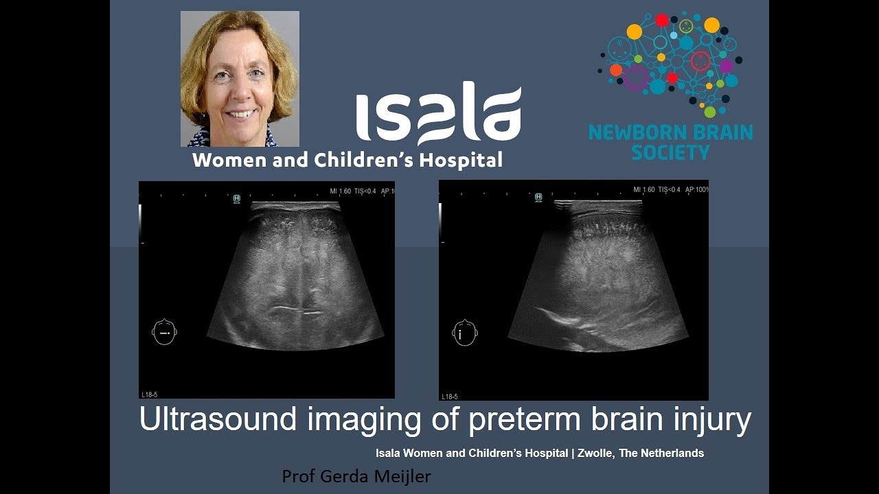 Ultrasound Imaging of Preterm Brain Injury  Prof Dr. Gerda Meijler