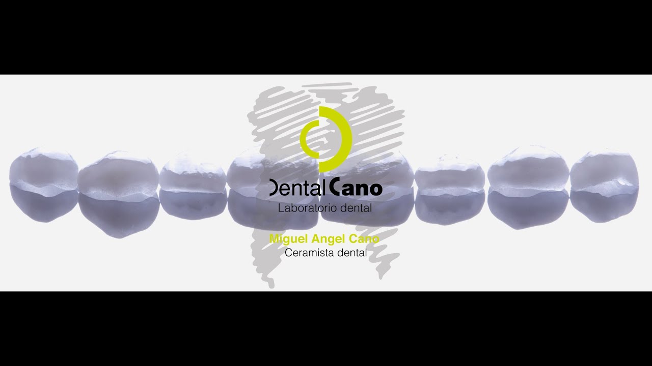Realización de carillas de cerámica paso a paso. Miguel Angel Cano. www.dentalcano.com