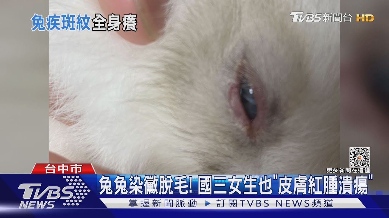 兔兔感染黴菌脫毛! 國三女生抱牠也「皮膚紅腫潰瘍」｜TVBS新聞 @TVBSNEWS01
