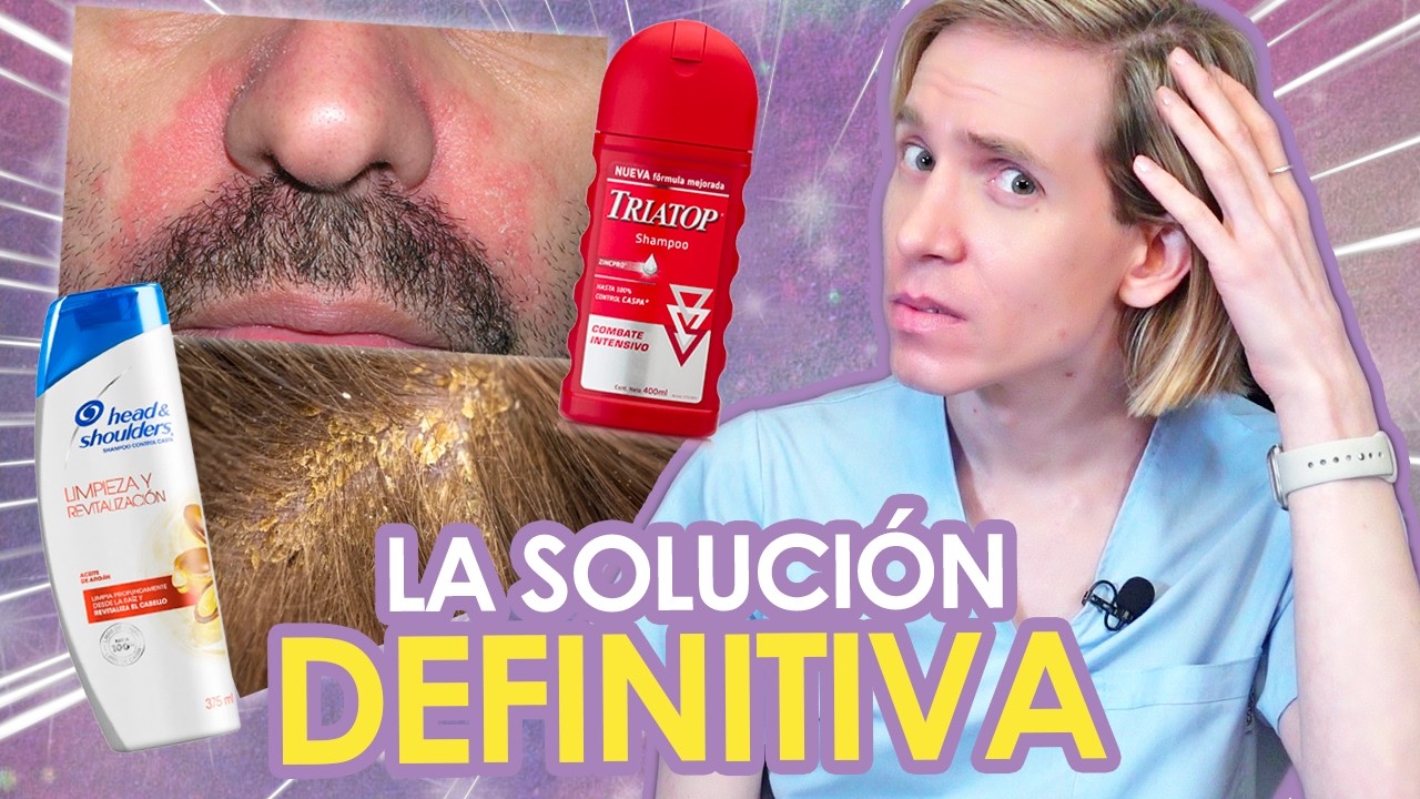 COMO SOLUCIONAR la CASPA y la DERMATITIS SEBORREICA -  DESDE CASA fácil y rápido - Simon Scarano