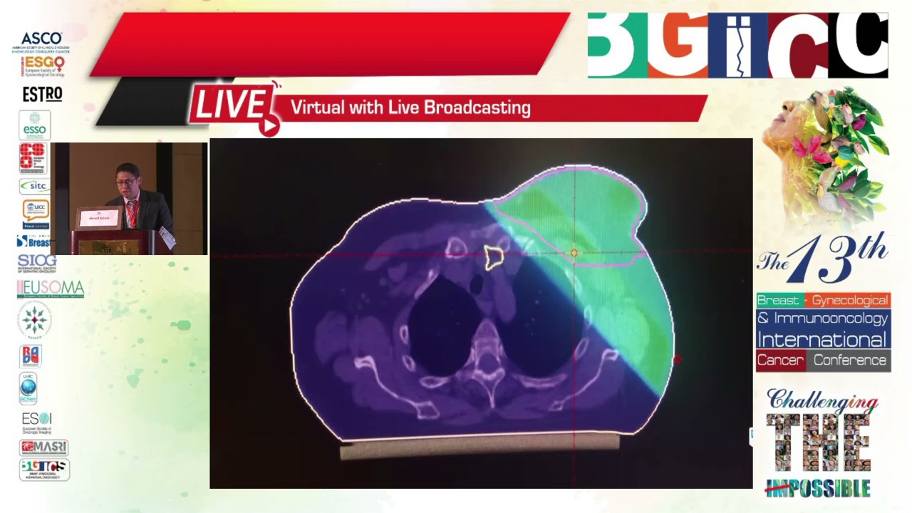 Tricks in breast cancer radiotherapy, a case presentation