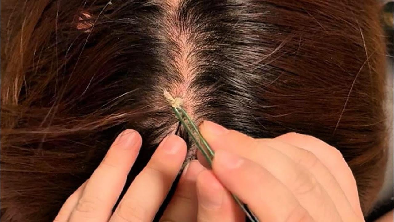 JOJO’s ASMR Scalp Care — Focused Tweezer Details for Calm, Quiet Relaxation | No Talking