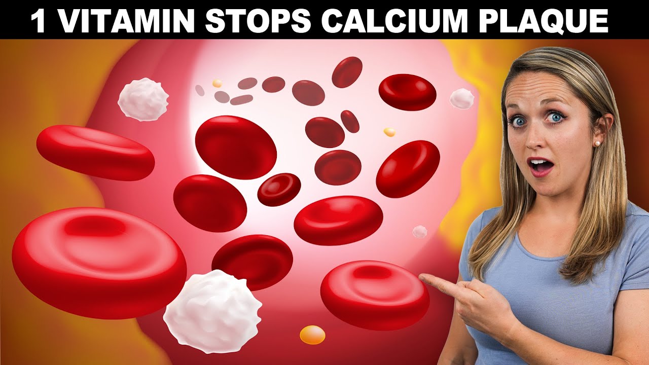 1 Simple Vitamin to Keep Your Arteries CLEAR