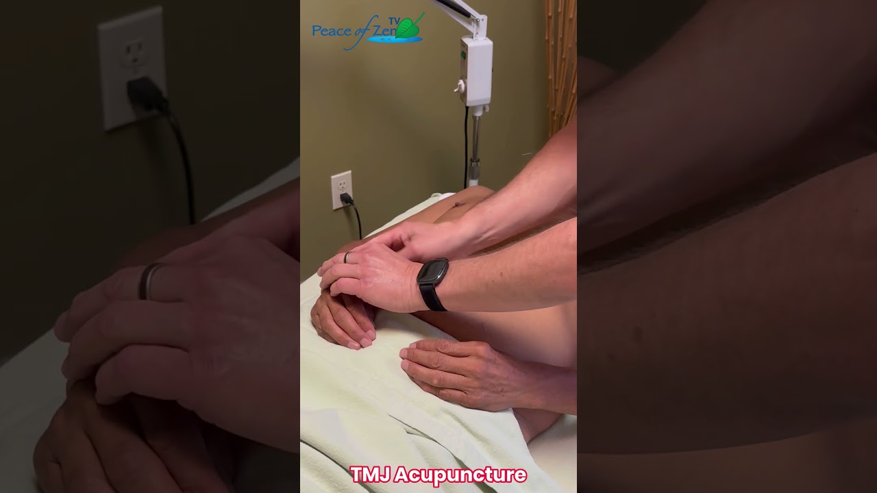 TMJ / TMD Relief with Acupuncture | Powerful Points for Jaw Tension & Clenching 