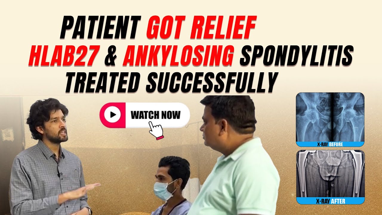 Patient Got Relief After (BIKINI) MIS DAA Technique | Ankylosing Spondylitis | In Delhi - NCR