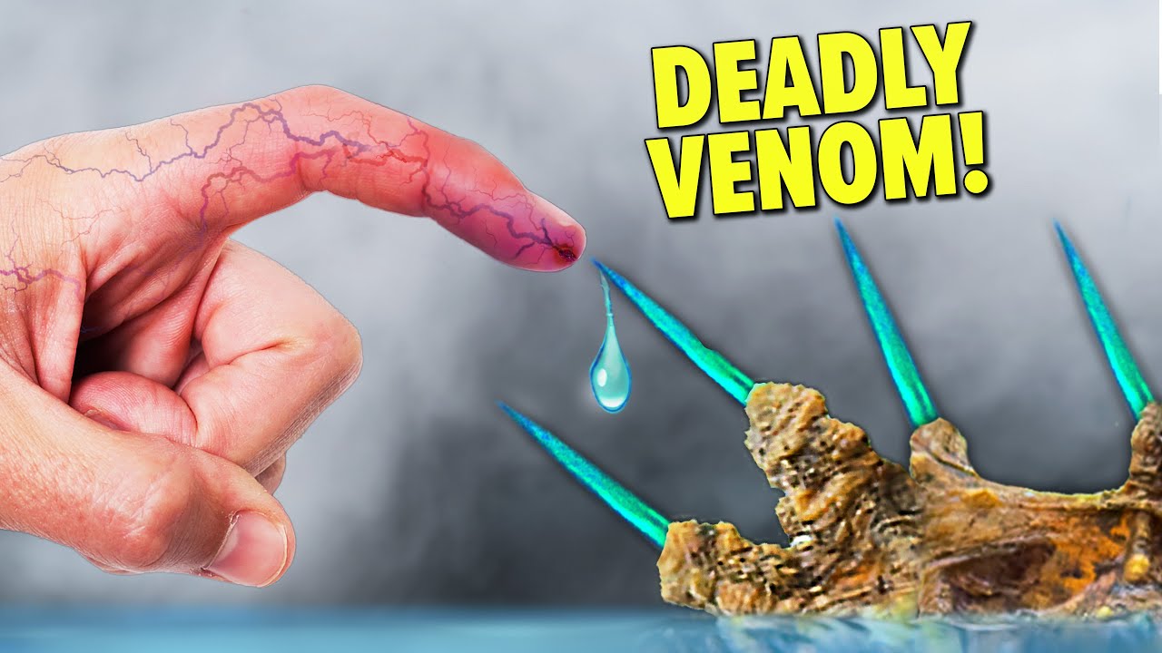 Stabbed by Deadliest Spines in the Ocean! ( Worst Stings RANKED!)
