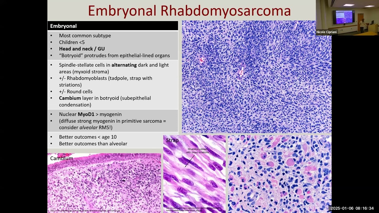 2025 01 06 Cipriani Soft Tissue part 2: Myogenic, Vascular, Neural tumors
