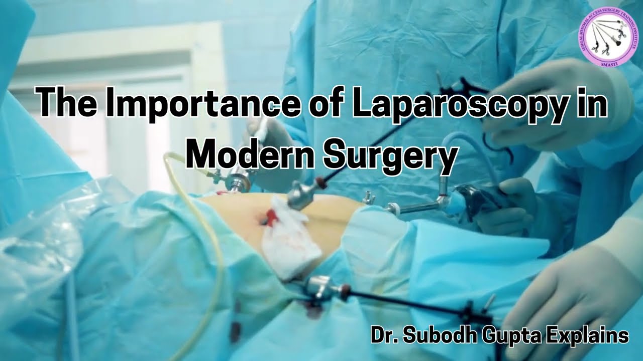 The Importance of Laparoscopy in Modern Surgery