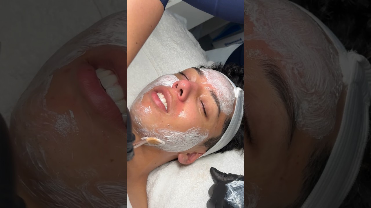 Facial Treatment on Acne-Prone Skin 🧖🏽&zwj;♀️👀☺️ #skincare #shorts