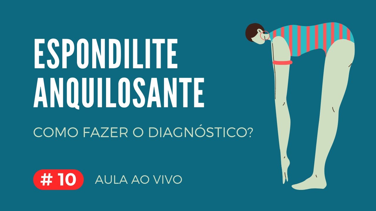 Espondilite Anquilosante: como fazer o diagnóstico?