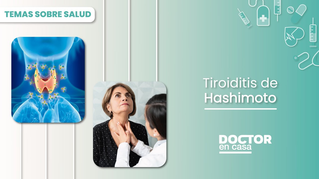 Tiroiditis de Hashimoto