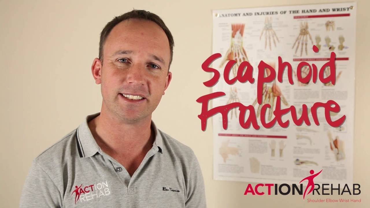 Scaphoid Fracture Treatment