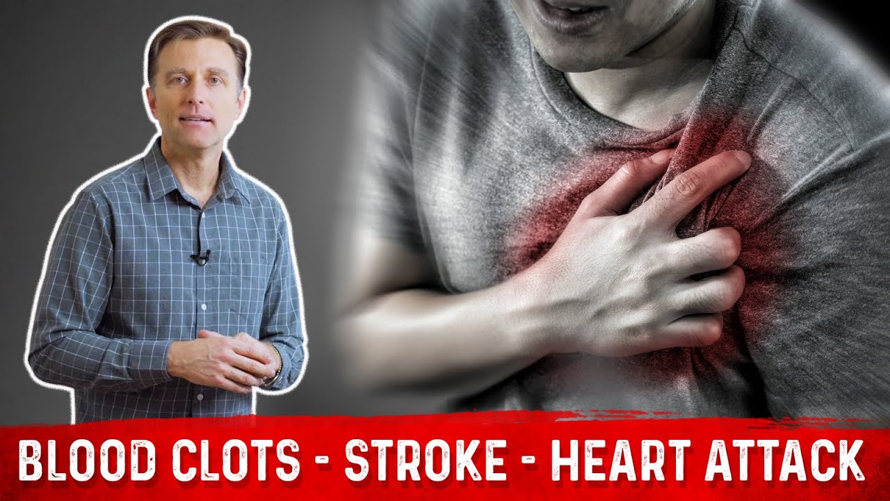 How to Prevent Blood Clots, Strokes & Heart Attacks? &ndash; Tips by Dr. Berg