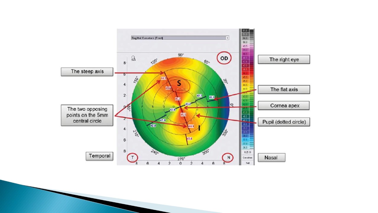 Corneal Topography   PENTACAM (Arabic Language)