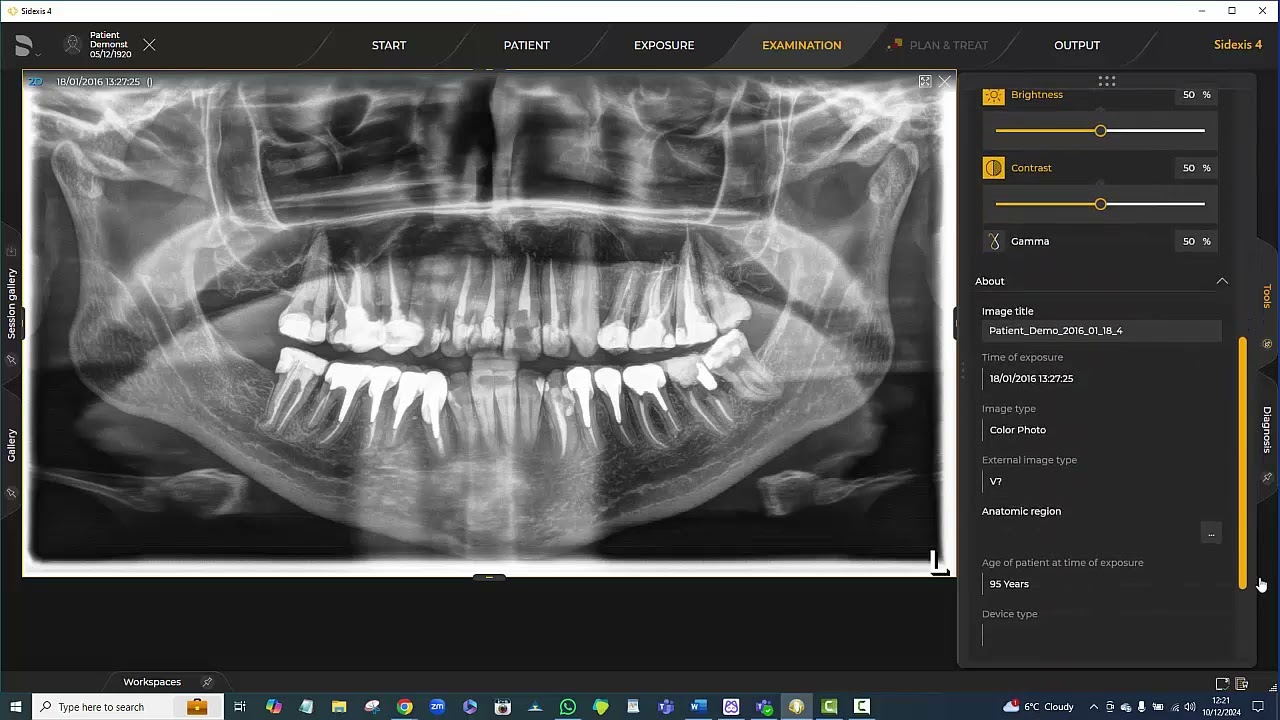 Working with OPG images in Sidexis 4 4