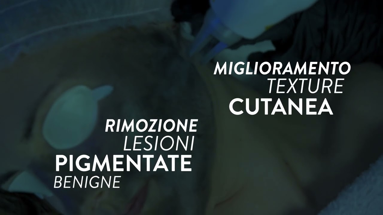 Xlase Plus: i migliori laser in un’unica piattaforma!