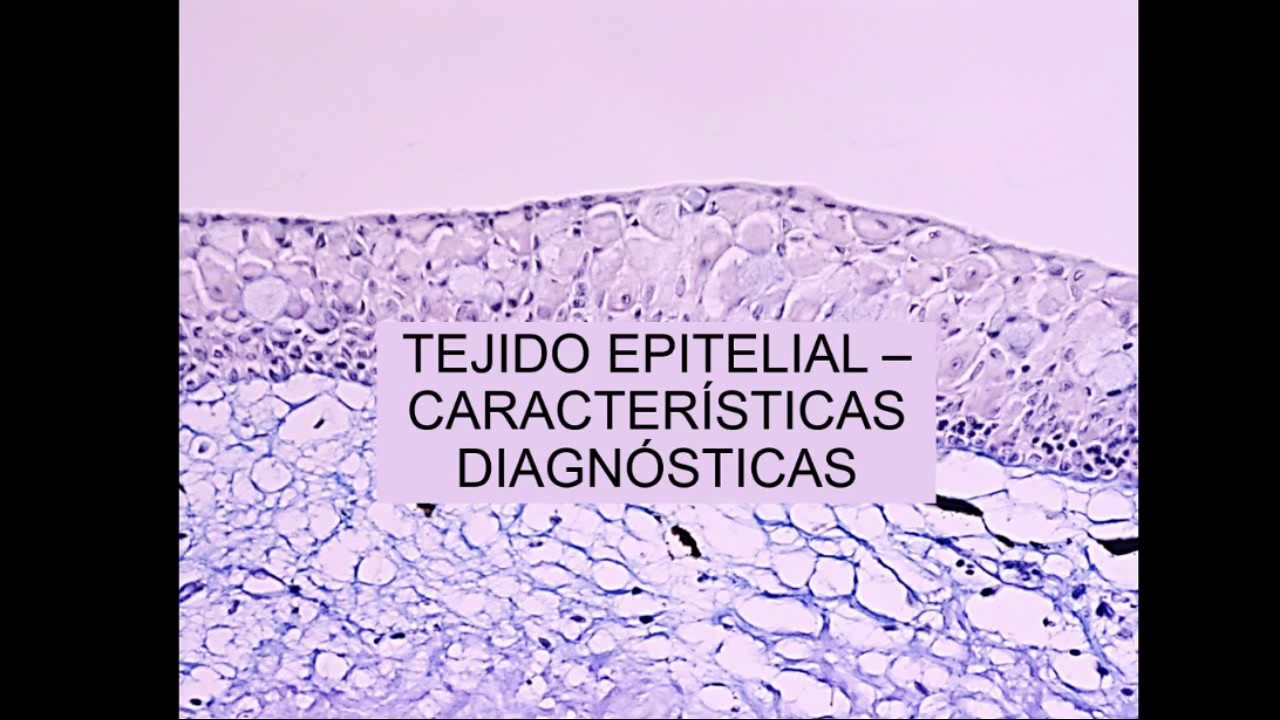 Tejido Epitelial Características Diagnósticas - Tejidos Básicos - Curso en Línea 2-002