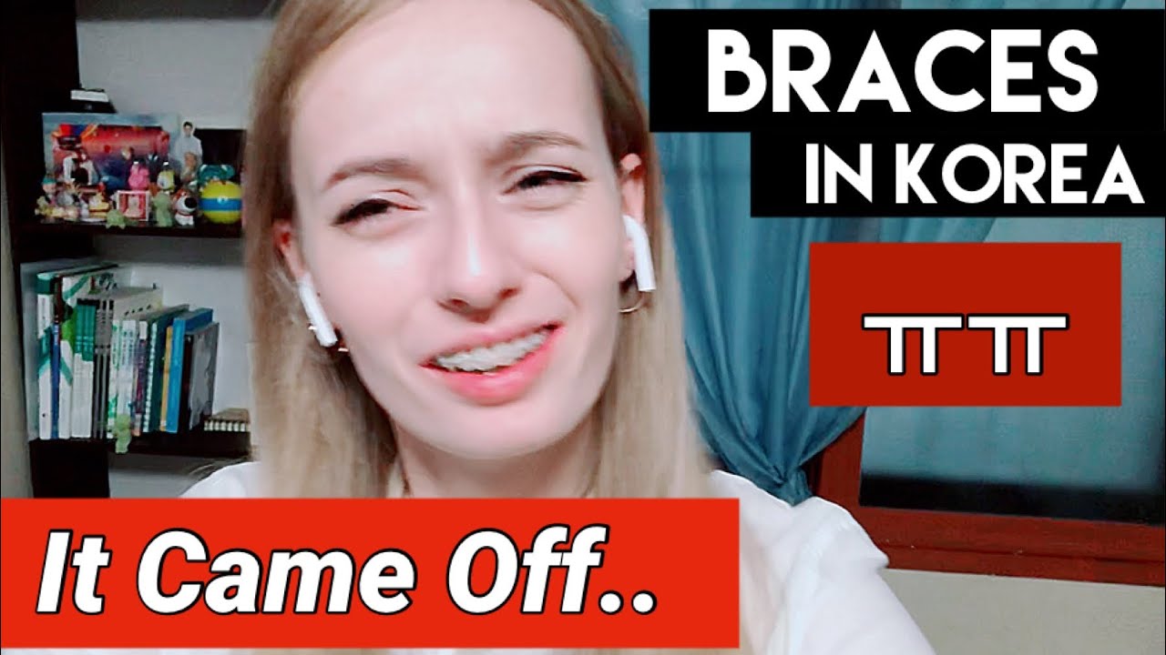 Problems and Stress | BRACES IN KOREA | Beebo
