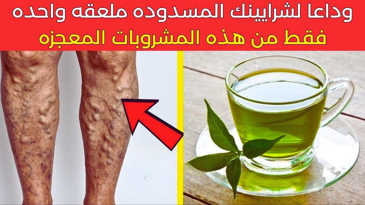 فوق سن الستين قل وداعا لانسداد الشرايين مع هذه الم
