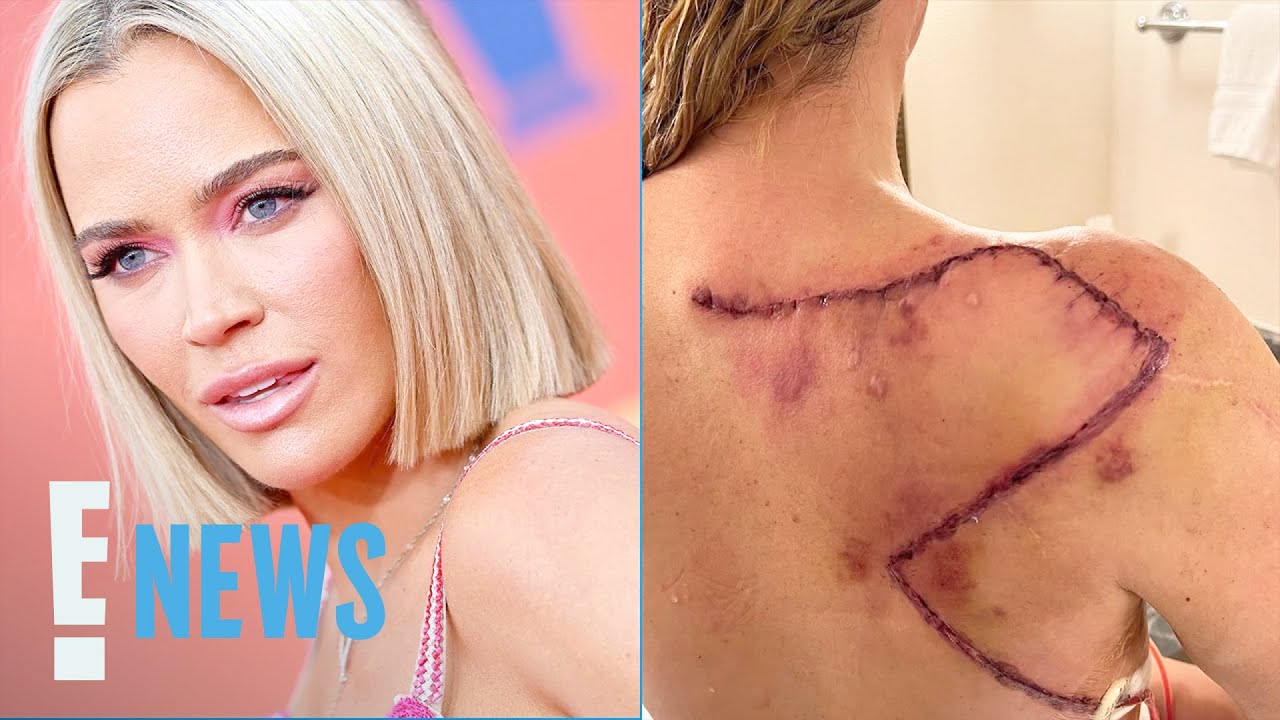 Teddi Mellencamp Reveals Large Scar Following Cancer Removal Surgery | E! News