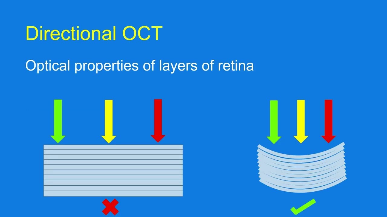 Directional OCT (D-OCT)