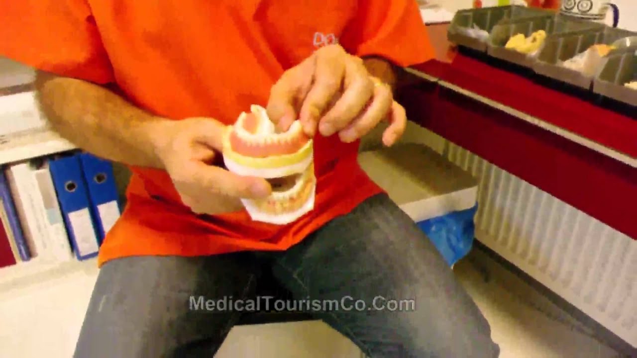 Dental Bridge and Veneer placement - Cosmetic Dentistry Turkey