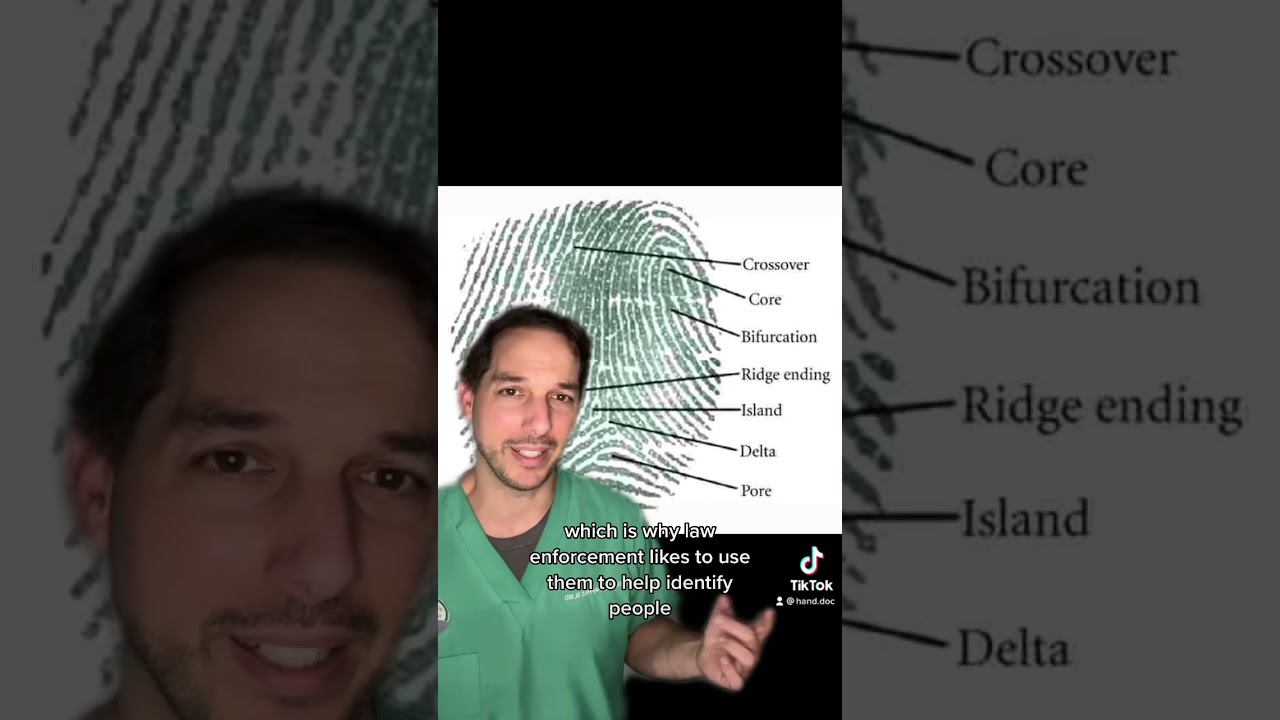Можно ли сжечь отпечатки пальцев? Хирург объясняет: #ОтпечаткиПальцев #Ожог #Медицина #Рука