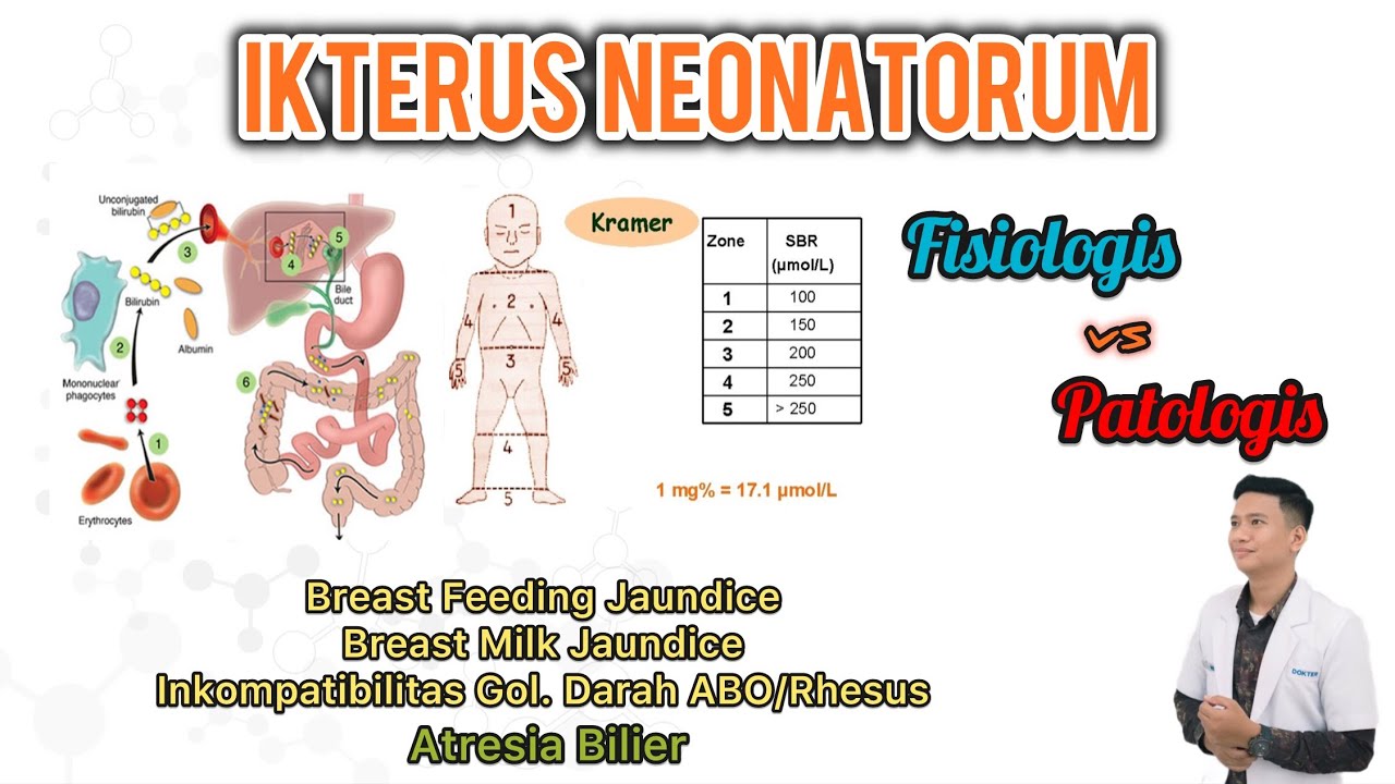 Penyebab Bayi Kuning? - Ikterus Neonatorum