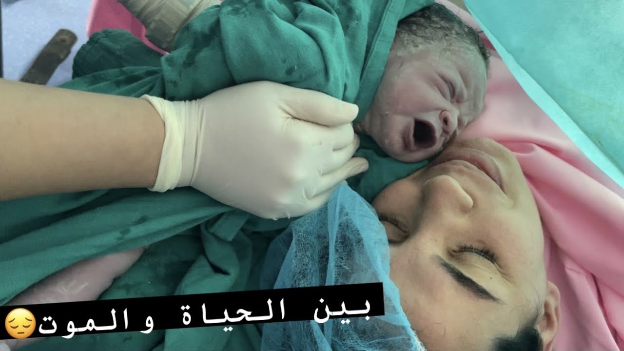ڤلوك الولادة 😔 لحضات وسط العملية بين الحياة والموت