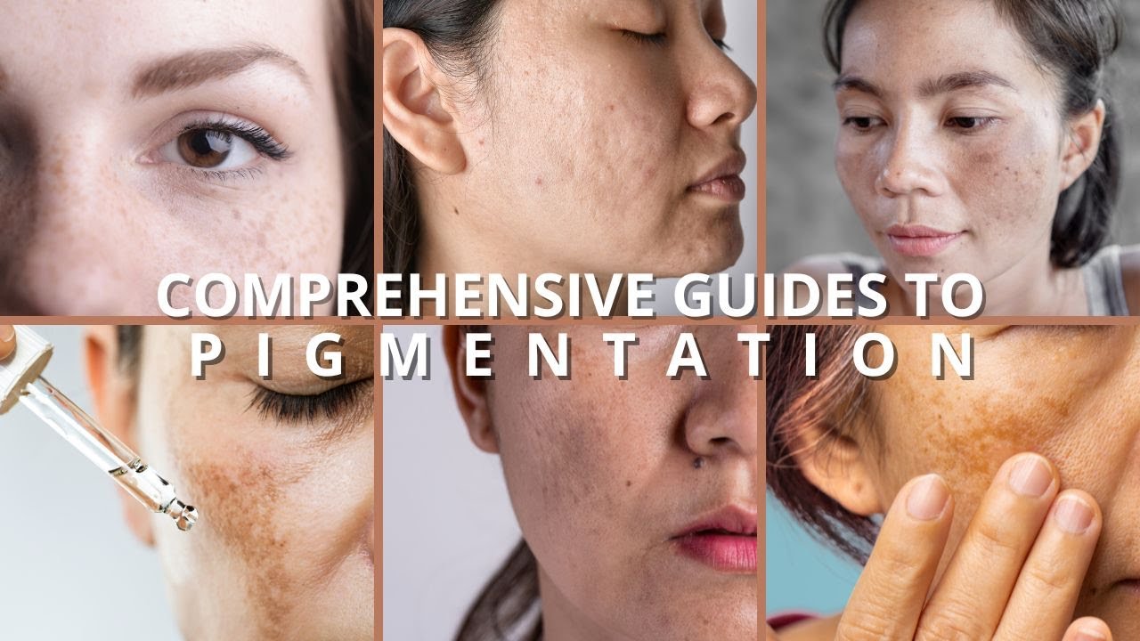 The Ultimate Guide to Types, Causes & Solutions for Different Skin Discolourations