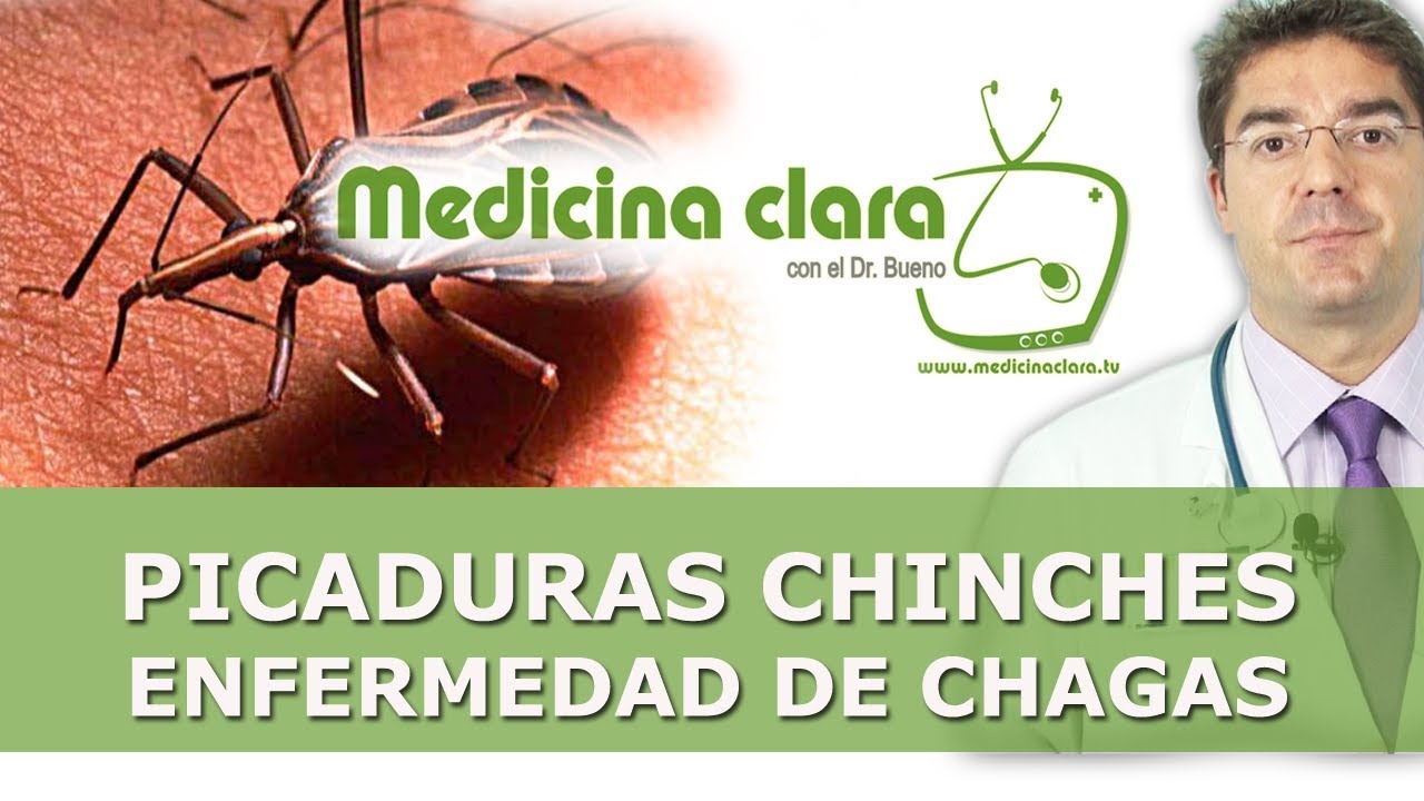 Picadura por chinches y enfermedad de Chagas | Como tratar las picaduras de chinches