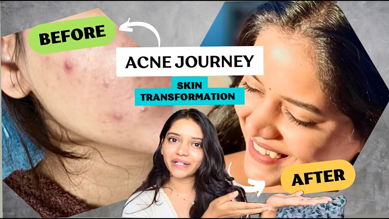 All about my SKINCARE | Shivani Yash Mathadhikari |