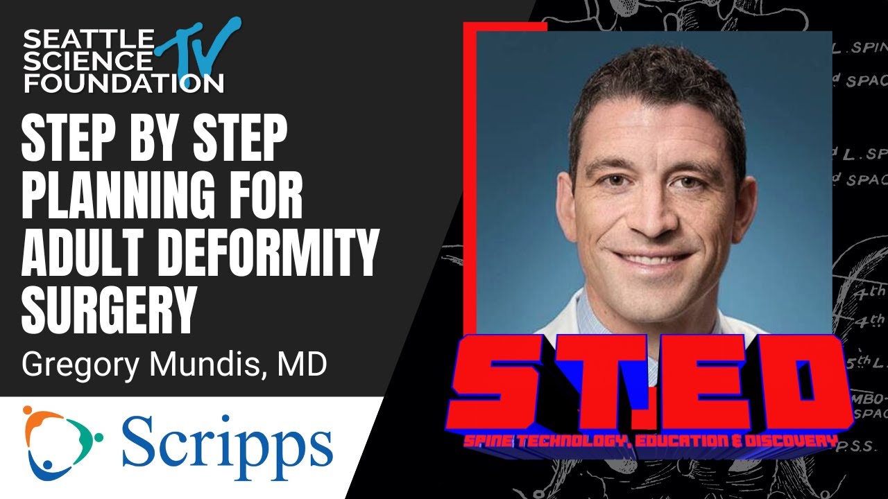 Step by Step Planning for Adult Spinal Deformity Surgery – Greg Mundis, MD