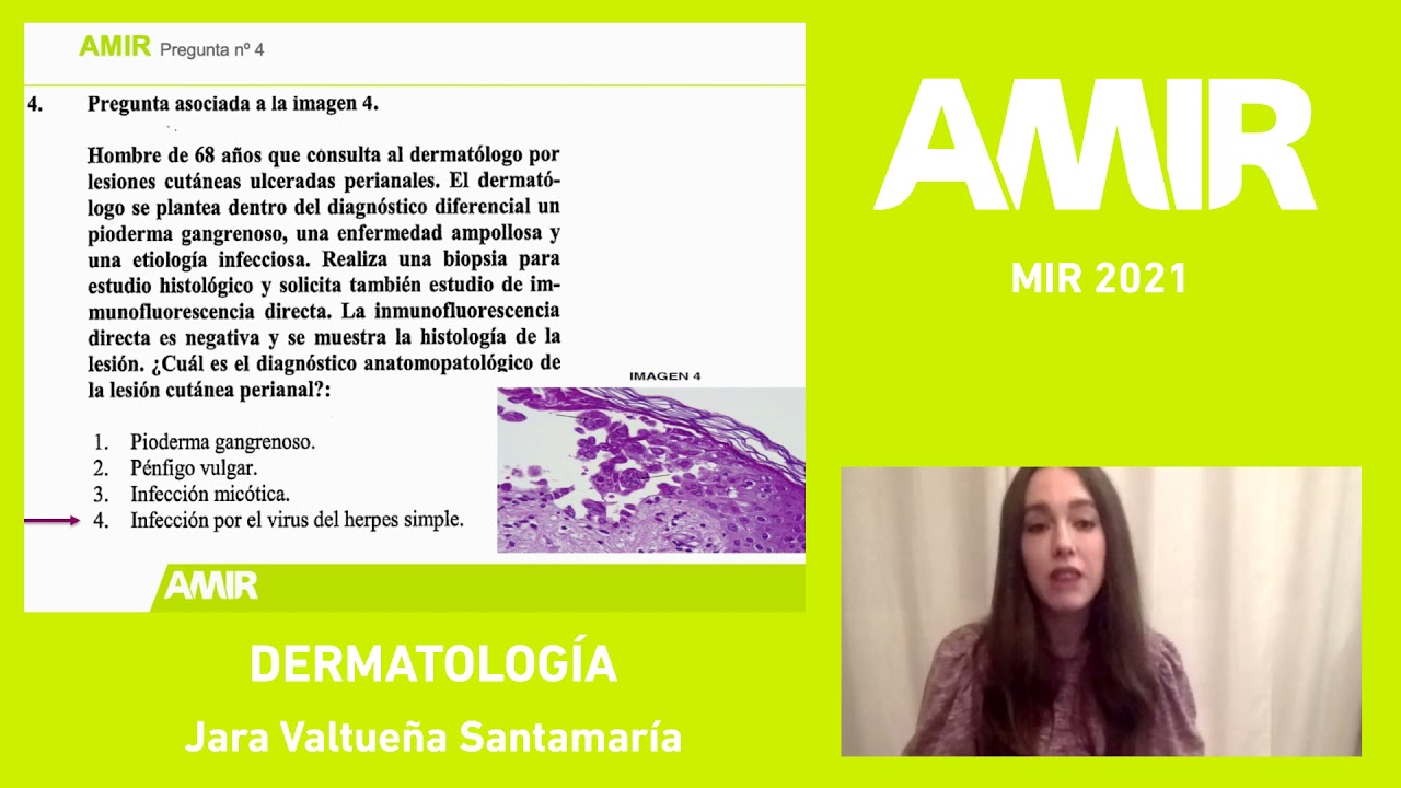 MIR 2021 | Dermatología | Jara Valtueña Santamaría