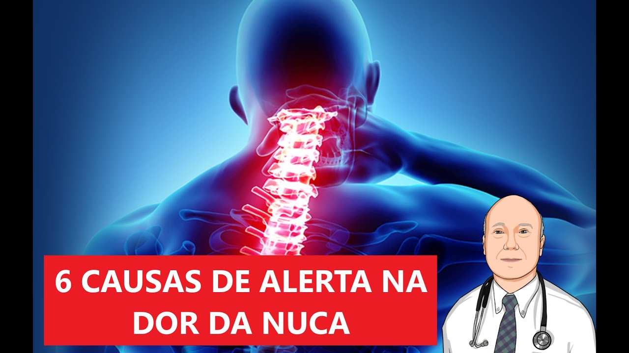 ALERTA: as 6 causas de dor na nuca e cervical que devem levar voc&ecirc; de imediato ao m&eacute;dico