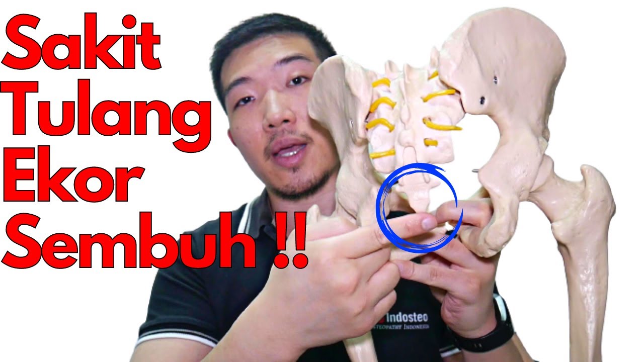 Sakit TULANG EKOR sembuh dengan mudah !!