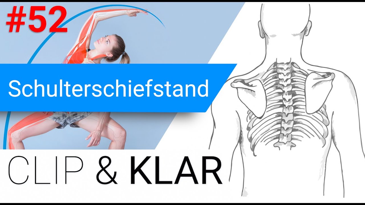 Schulterschiefstand erkl&auml;rt - Der Brandstifter ist nicht dort wo es brennt