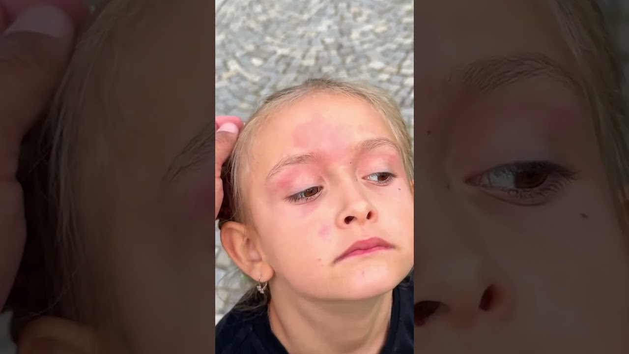 Arianka m&aacute; alergii 🤧🌸