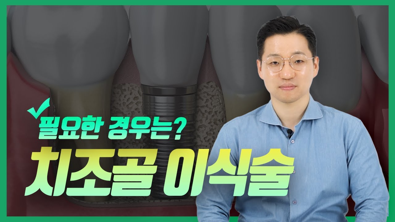 치조골 이식 임플란트란? | 치조골 이식술이 필요한 경우에 대해 알아보자!