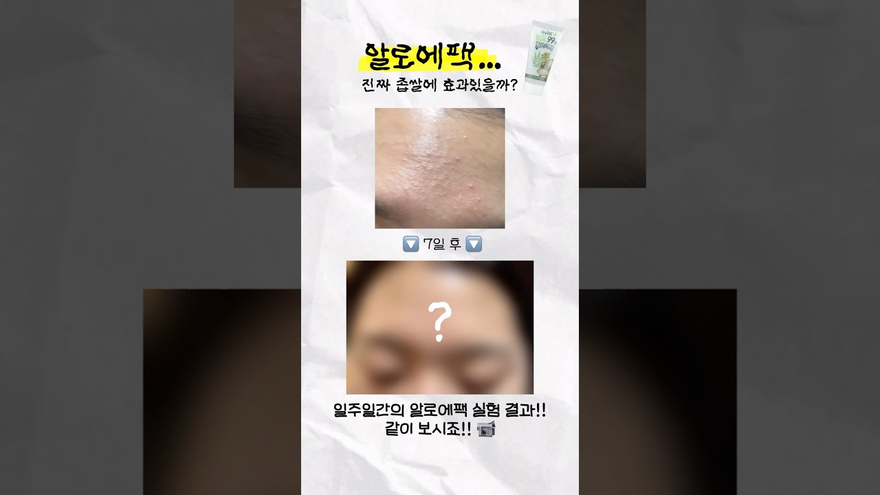 7일간의 알로에팩 효과 유무 실험..🧪