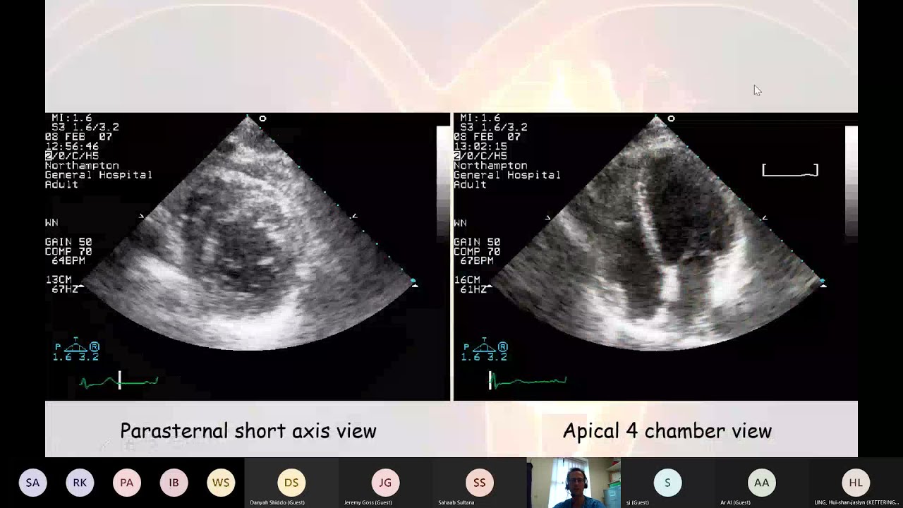 21 06 04 Echocardiogram interpretation