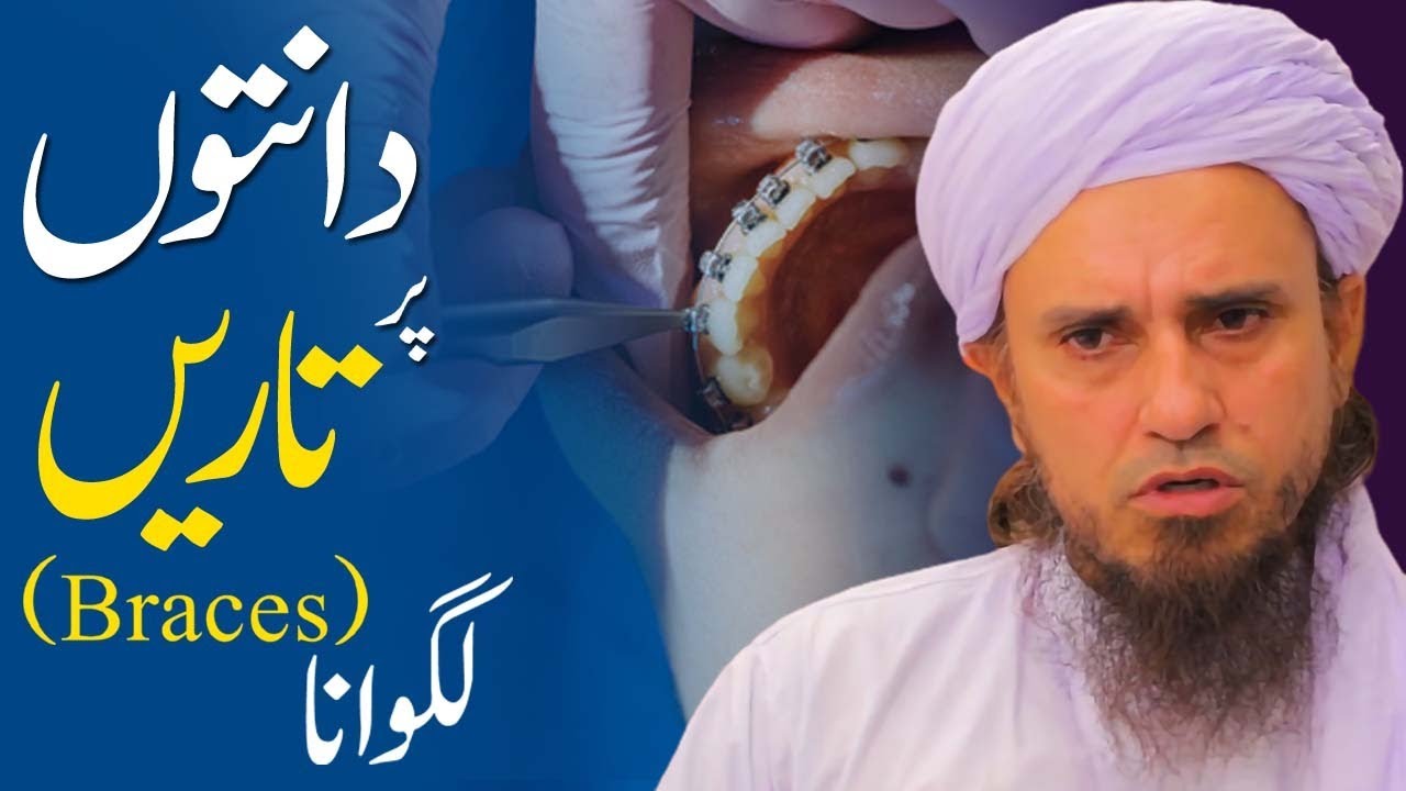Daanton pr taren (braces) lagwana | Ask Mufti Tariq Masood