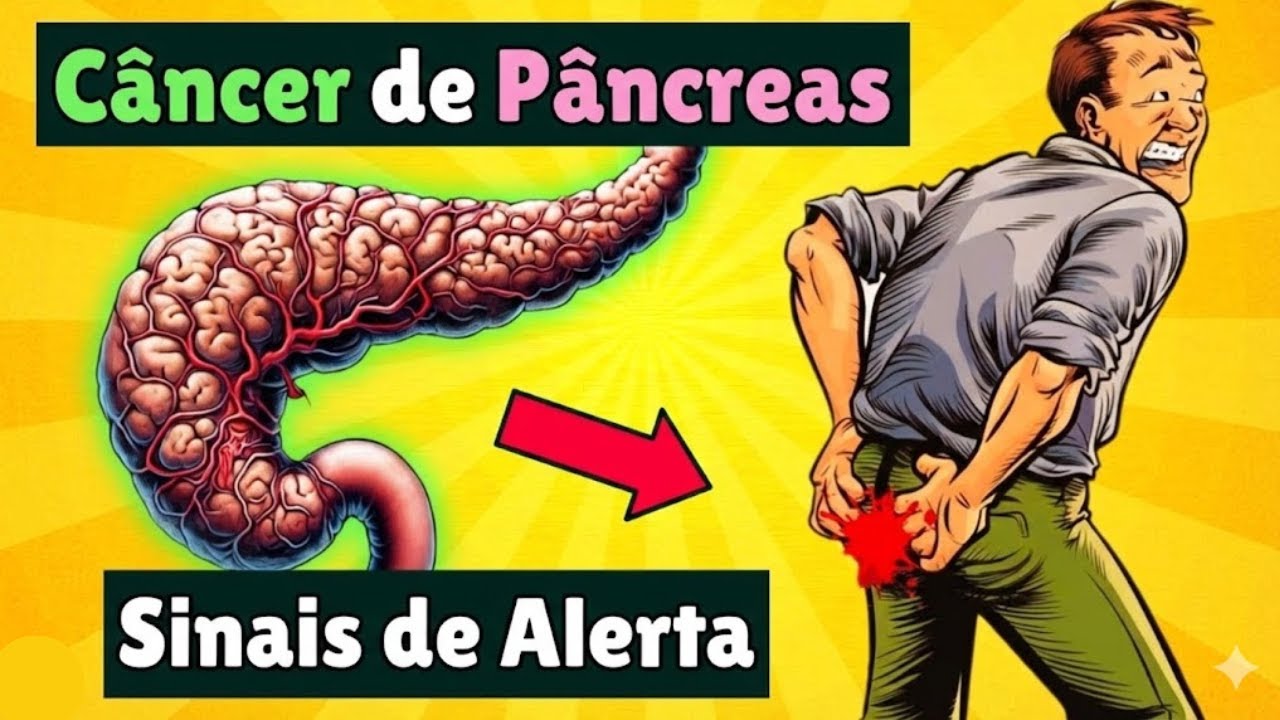 12 Sinais de Alerta de Câncer de Pâncreas Que Vão Te Chocar