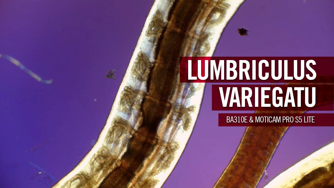 Lumbriculus variegatus - The blackworm | by Motic Europe