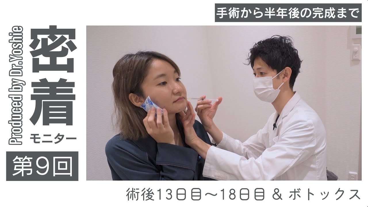 【モニター完全密着】「13日目〜18日目＆ボトックス」の全てを公開（第9話）／吉江秀和 医師｜Mods Clinic（モッズクリニック）