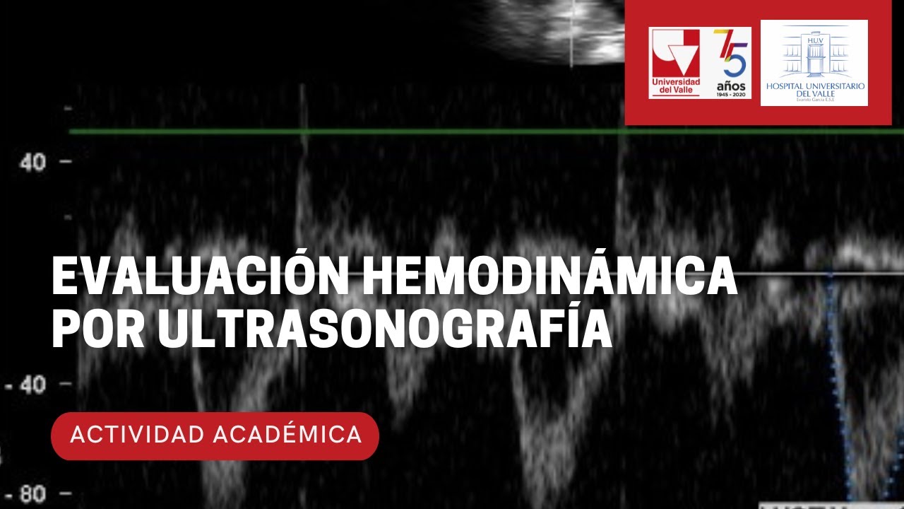 Evaluación hemodinámica por ultrasonografía